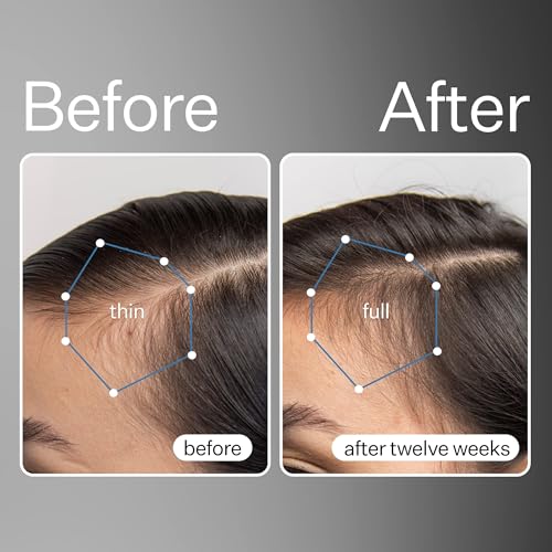 ACT+ ACRE Cold Processed Stem Cell Scalp Serum - Promotes Thicker and Fuller-Looking Hair - Soothes and Hydrates the Scalp - Sulphate and Paraben Free - Aloe Vera for Improved Scalp Health - 1 fl oz.