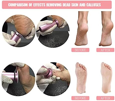 Electric Foot File Callus Remover Professional Foot File Pedicure Tools Adjustable Speed 120pcs Replacement Sandpaper disc Easy to Remove Cutin Dead Skin calluses(Black 120pcs)