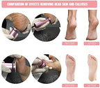 Electric Foot File Callus Remover Professional Foot File Pedicure Tools Adjustable Speed 120pcs Replacement Sandpaper disc Easy to Remove Cutin Dead Skin calluses(Black 120pcs)
