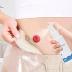 ovand 30ml Ostomy Skin Barrier Spray, No-Alcohol No-Sting Ostomy Care Skin Barrier Spray Colostomy Supplies Accessories (2 Bottle)
