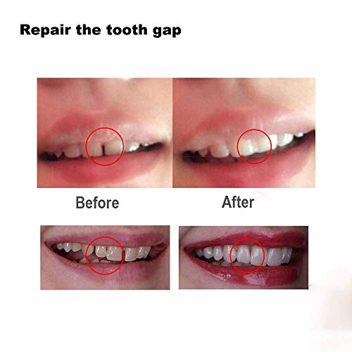 BRIGE Tooth Filling Thermal Beads Do it Yourself Moldable False Teeth for Temporary Teeth Repair The Missing and Broken Tooth Replacement Kit(2 pack)