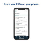 KardiaMobile 1-Lead Personal EKG Monitor – Record EKGs at Home – Detects AFib and Irregular Arrhythmias – Instant Results in 30 Seconds – Easy to Use – Works with Most Smartphones - FSA/HSA Eligible