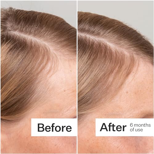 Act+Acre 3-Pack Mini Cold Processed Stem Cell Scalp Serum - Promotes Thicker and Fuller-Looking Hair - Soothes and Hydrates the Scalp - Sulphate and Paraben Free - Aloe Vera for Improved Scalp Health.