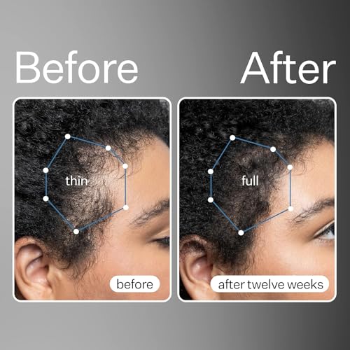 Act+Acre 3-Pack Mini Cold Processed Stem Cell Scalp Serum - Promotes Thicker and Fuller-Looking Hair - Soothes and Hydrates the Scalp - Sulphate and Paraben Free - Aloe Vera for Improved Scalp Health.