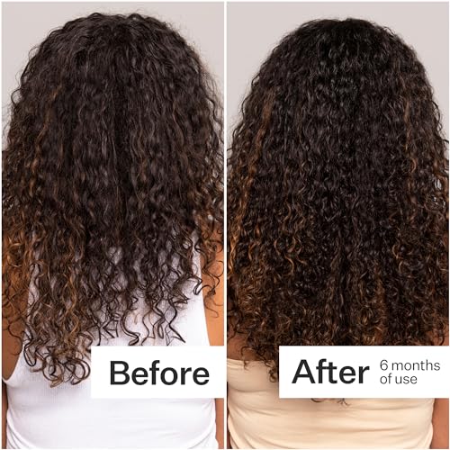 ACT+ ACRE Cold Processed Stem Cell Scalp Serum - Promotes Thicker and Fuller-Looking Hair - Soothes and Hydrates the Scalp - Sulphate and Paraben Free - Aloe Vera for Improved Scalp Health - 1 fl oz.