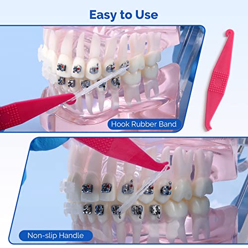 JMU Orthodontic Rubber Bands 1/4 Medium 6.4 mm Clear Orthodontic Elastic 4.5oz 500 pack Latex Free Dental Rubber Bands Made in USA