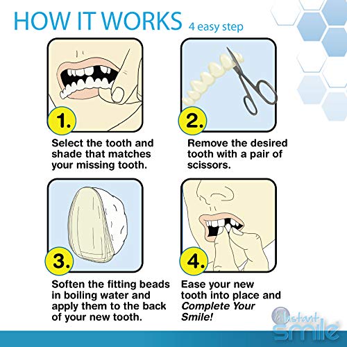 INSTANT SMILE Complete Your Smile Temporary Tooth Replacement Kit - Replace a Missing Tooth in Minutes - Patented