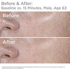 SkinMedica HA5 Rejuvenating Hydrator. Hyaluronic Acid Serum for Face with Five Types of Hyaluronic Acid that Smooth Fine Lines and Wrinkles, For All Skin Types, 1 Oz