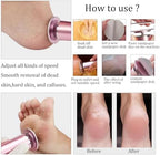 Electric Foot File Callus Remover Professional Foot File Pedicure Tools Adjustable Speed 120pcs Replacement Sandpaper disc Easy to Remove Cutin Dead Skin calluses for Men and Women(Rose Gold 120pcs)