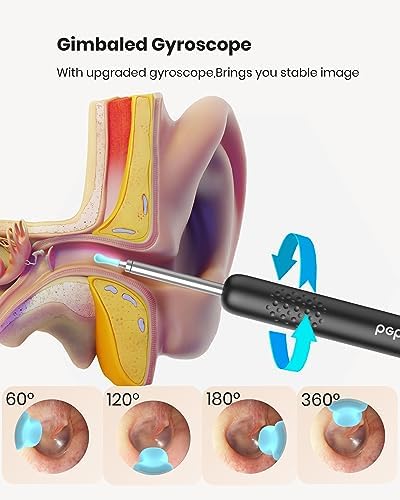 BEBIRD R1 Wax Removal Tool for Ear - Spade Ear Canal Cleaner with Camera 1080P Earscope, Wax Remove Ear Picker with Vari Replacement Tips, Camera with 6LED Light for Ear/Nose/Throat Examination, Black