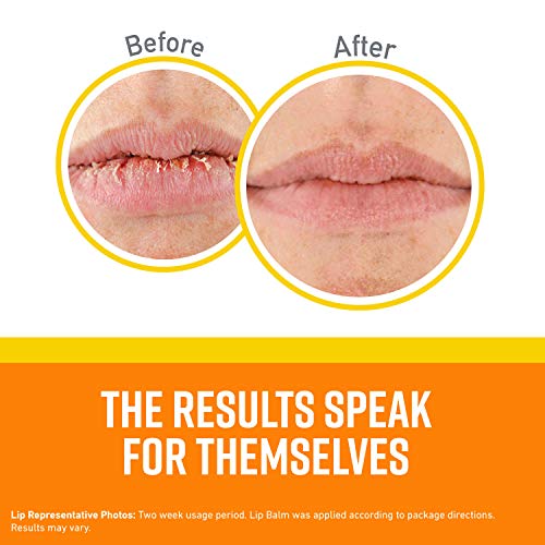 O'Keeffe's Lip Repair SPF 35 Lip Balm, (Pack of 2)