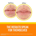 O'Keeffe's Lip Repair SPF 35 Lip Balm, (Pack of 2)