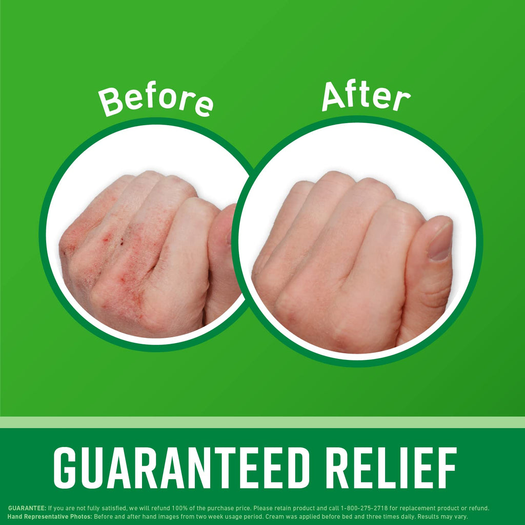 O'Keeffe's Working Hands Hand Cream, Relives and Repairs Extremely Dry Hands, 7 oz Tube (Pack of 1)