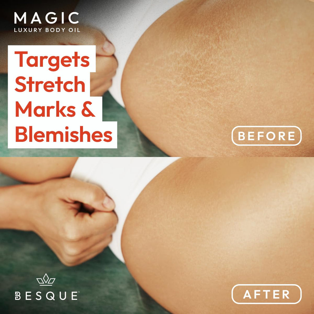 Besque Magic Body Oil, 3.4 FL OZ, After Shower Body Oil For Women, Hydrating Skin Care For Full Body That Plumps, Tightens, and Firms Skin With Natural Ingredients, Luxury Spa Gifts - Pack of 1