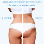 VYRKRA Body Sculpting Machine - Cellulite Massager with 6 Pads, Lymphatic Drainage Massage with Vibration & Rotation, Electric Body Massager for Abdomen/Love Handles/Butt/Legs/Back/Arms