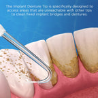 Replacement Tips for Waterpik Water Flosser (6 Implant Denture Tips)