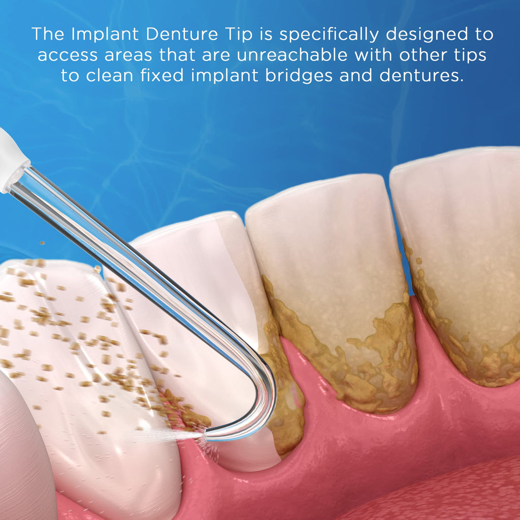 Replacement Tips for Waterpik Water Flosser (6 Implant Denture Tips)