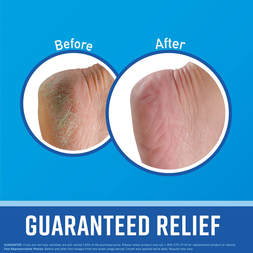 O'Keeffe's for Healthy Feet Foot Cream, Guaranteed Relief for Extremely Dry, Cracked Feet, Instantly Boosts Moisture Levels, 3.2 Ounce Jar, (Pack of 12)