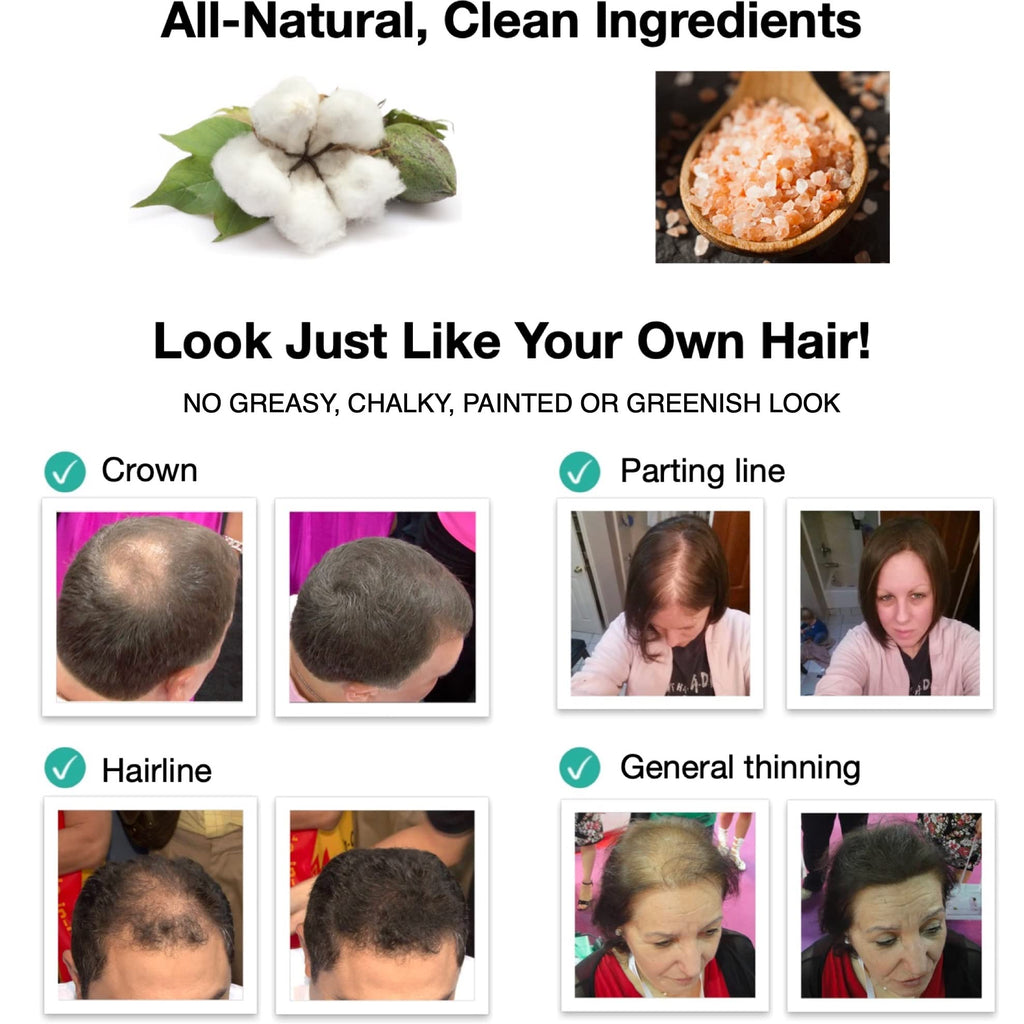Caboki Hair Loss Concealer. All-Natural Hair Building Fiber. Make Thin Hair Look 10X Fuller Instantly. Eliminate The Appearance of Bald Spot and Thinning Hair (30G, 90-Day Supply). Gray