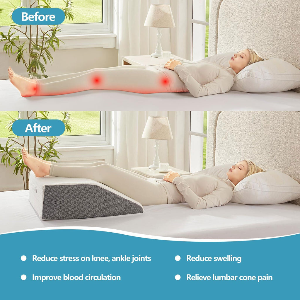 Nordjager Leg Pillow for Elevation & Support, 24"x22"x8" Memory Foam Cushion with Grey White Patterned Polyester Cover, Ideal for Improving Circulation & Relaxing Leg