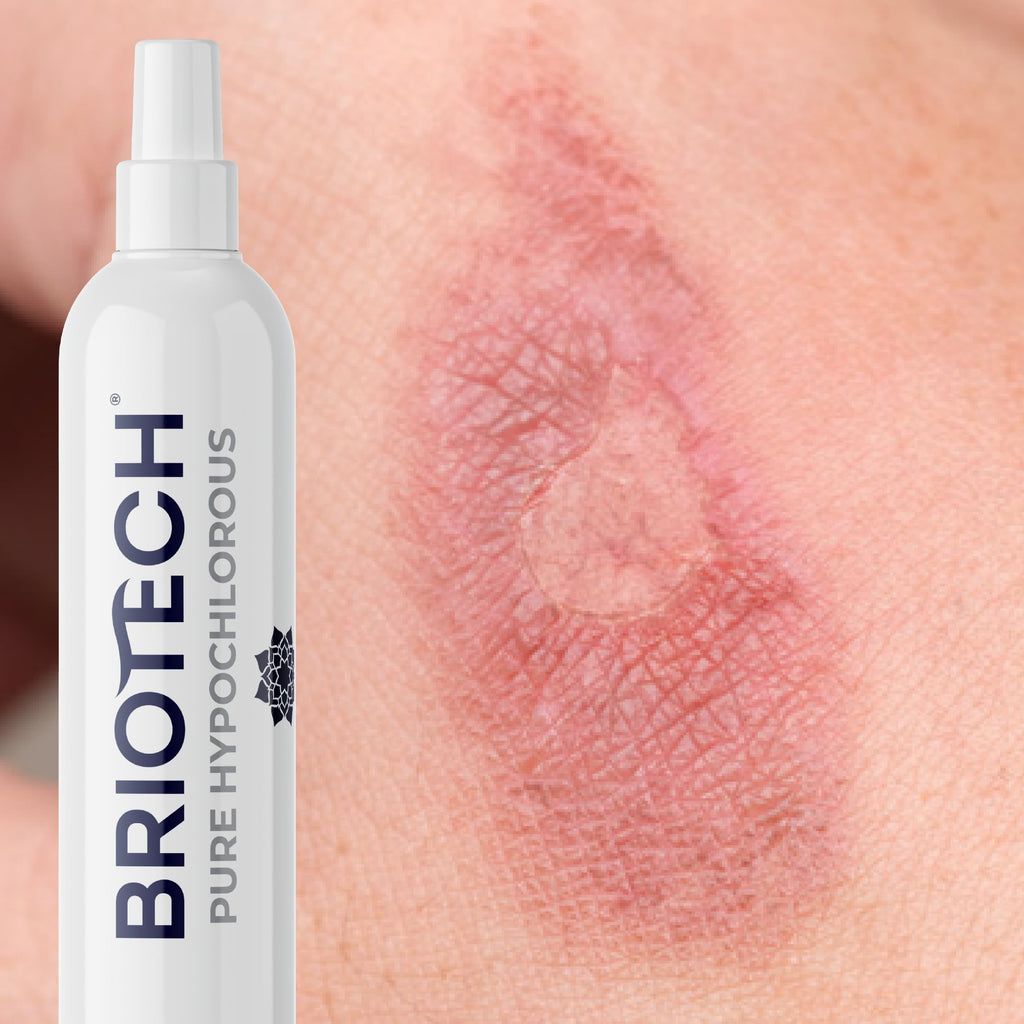 BRIOTECH Pure Hypochlorous Acid Spray and Cleanser, Original Premium HOCl Topical Solution, Multi-Purpose Cleaner, Family Approved & Pet Friendly, 1 gal ea, 2 ct