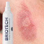 BRIOTECH Pure Hypochlorous Acid Spray and Cleanser, Original Premium HOCl Topical Solution, Multi-Purpose Cleaner, Family Approved & Pet Friendly, 1 gal ea, 2 ct