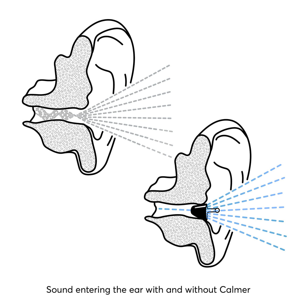 Flare Calmer – Ear Plugs Alternative – Reduce Annoying Noises Without Blocking Sound – Soft Reusable Silicone - Purple