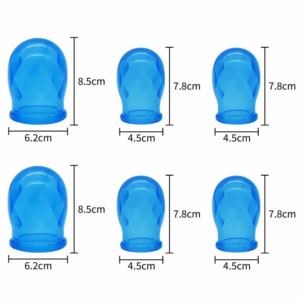 RUIZD 6 Cups Cupping Set Chinese Massage Medical Body Healthy Therapy Vacuum Suction